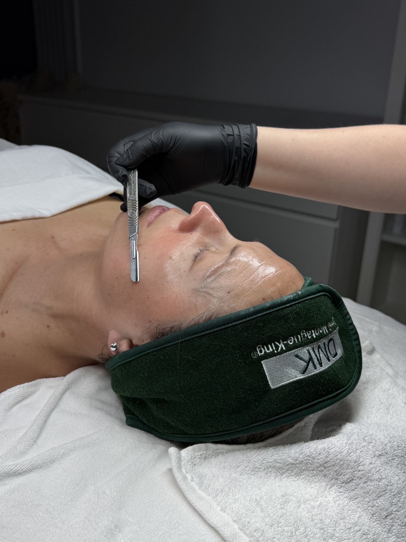 Dermaplaning add-on special at SBW Beauty