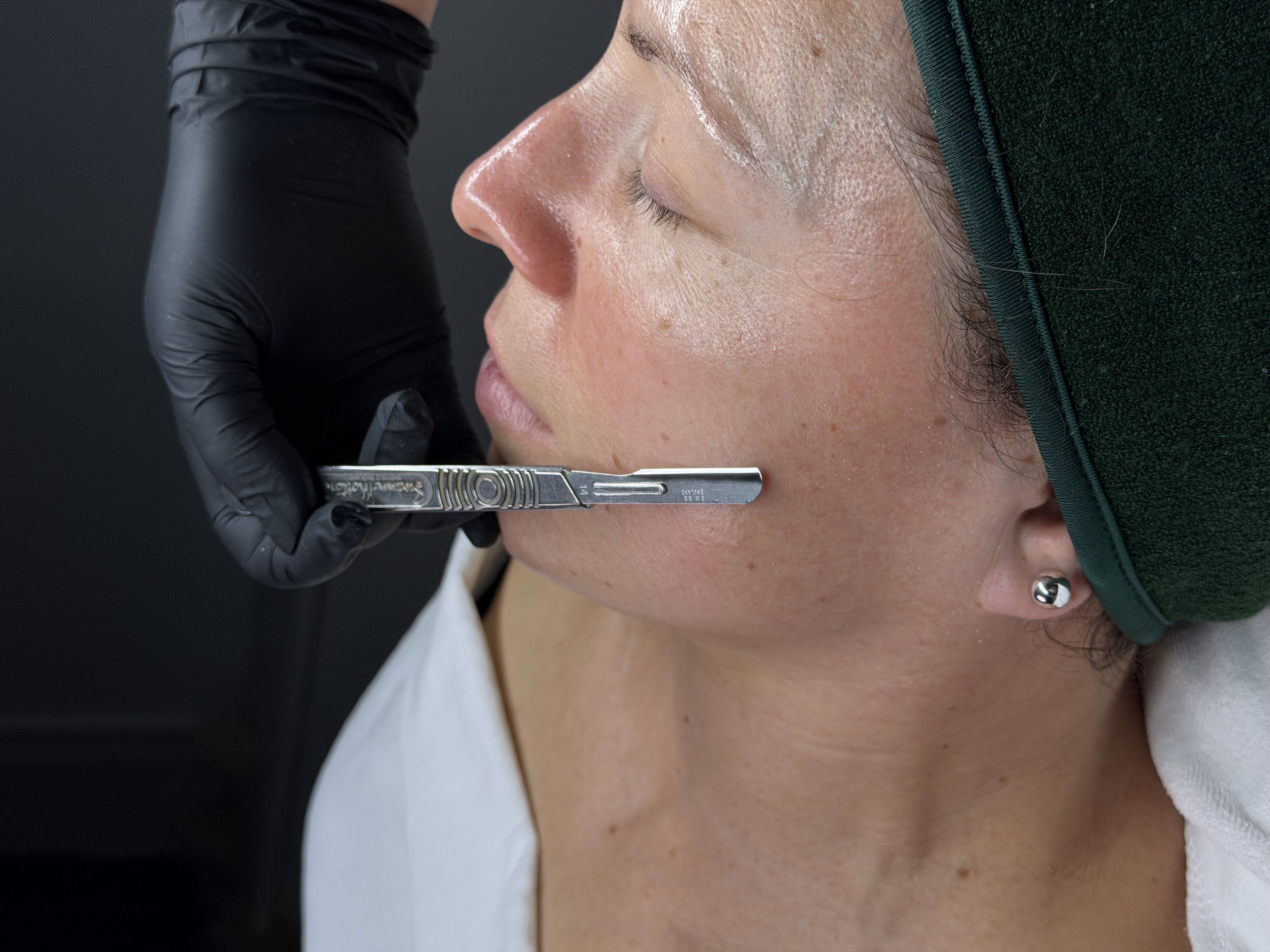 Relaxing dermaplaning facial treatment room in Peabody MA