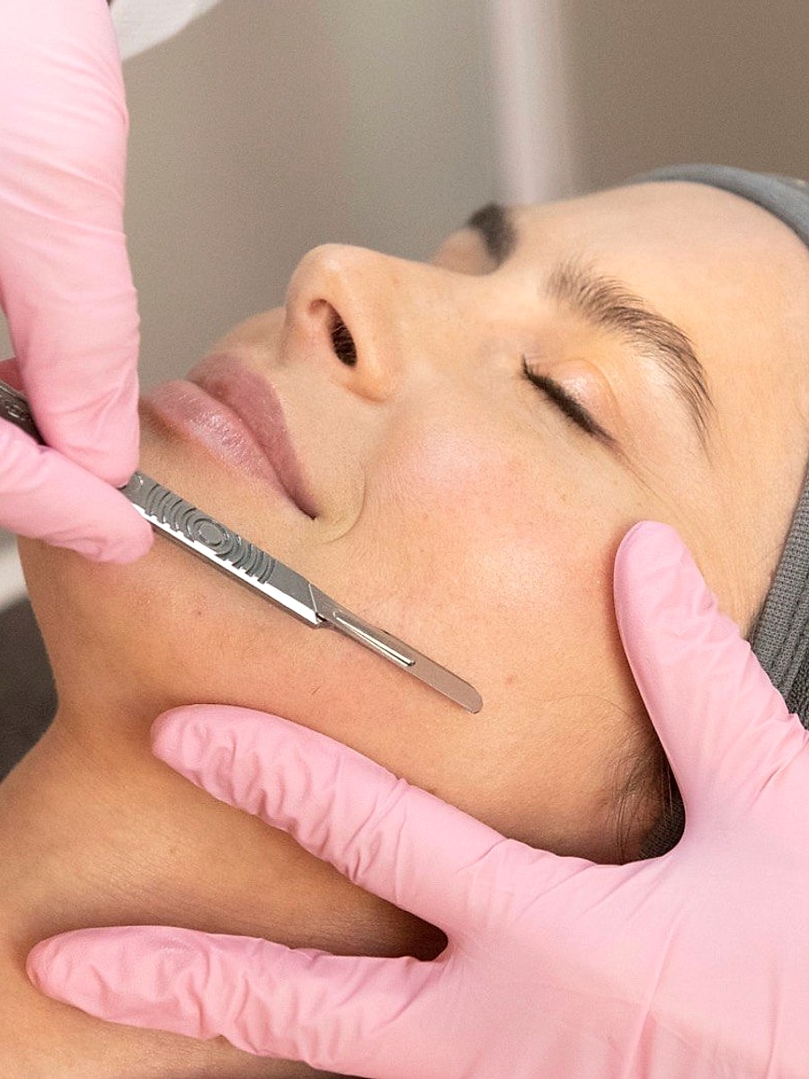 Dermaplaning facial treatment at SBW Beauty
